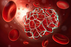 anticoagulation