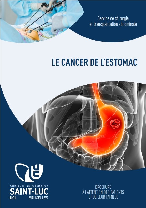 Le cancer de l'estomac