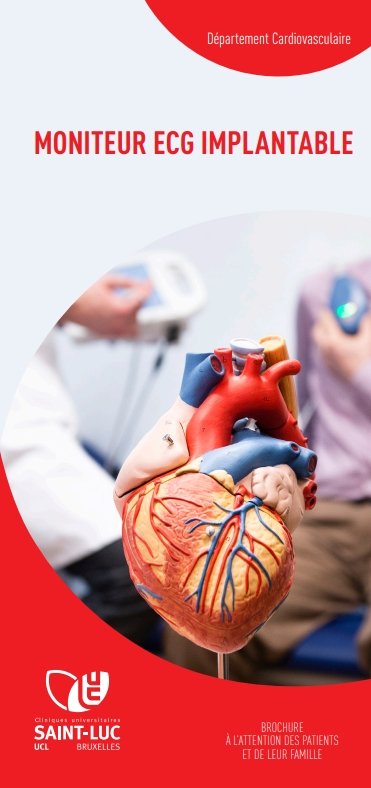 Moniteur ECG implantable