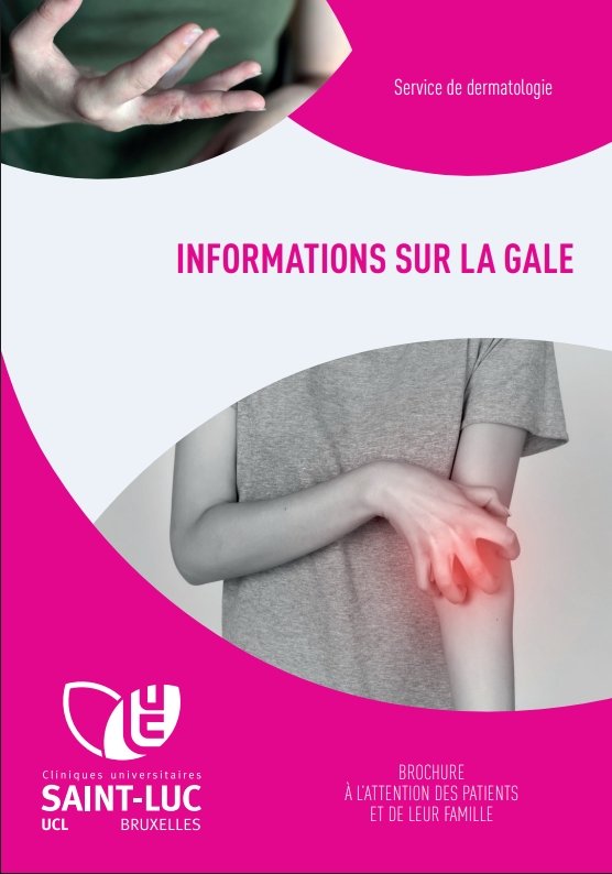 Informations sur la gale
