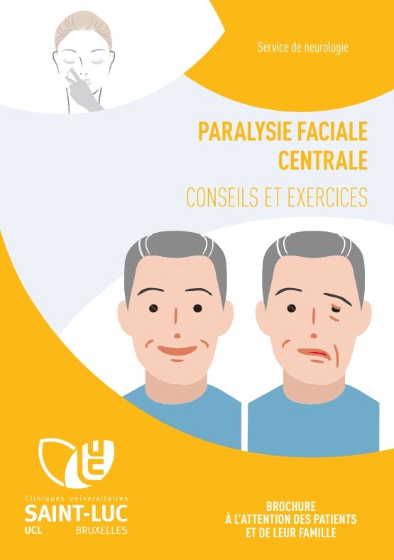 Paralysie faciale centrale - conseils et exercices