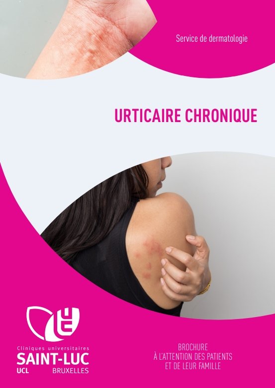 Urticaire chronique