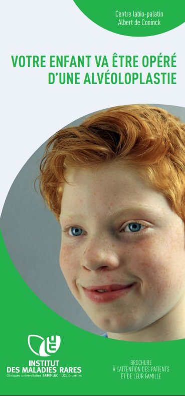 Votre enfant va être opéré d'une alvéoloplastie