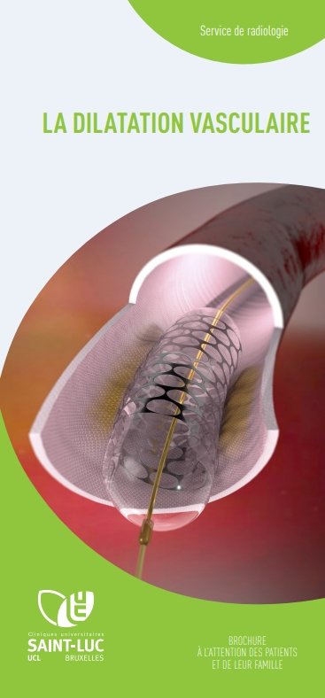 La dilatation vasculaire