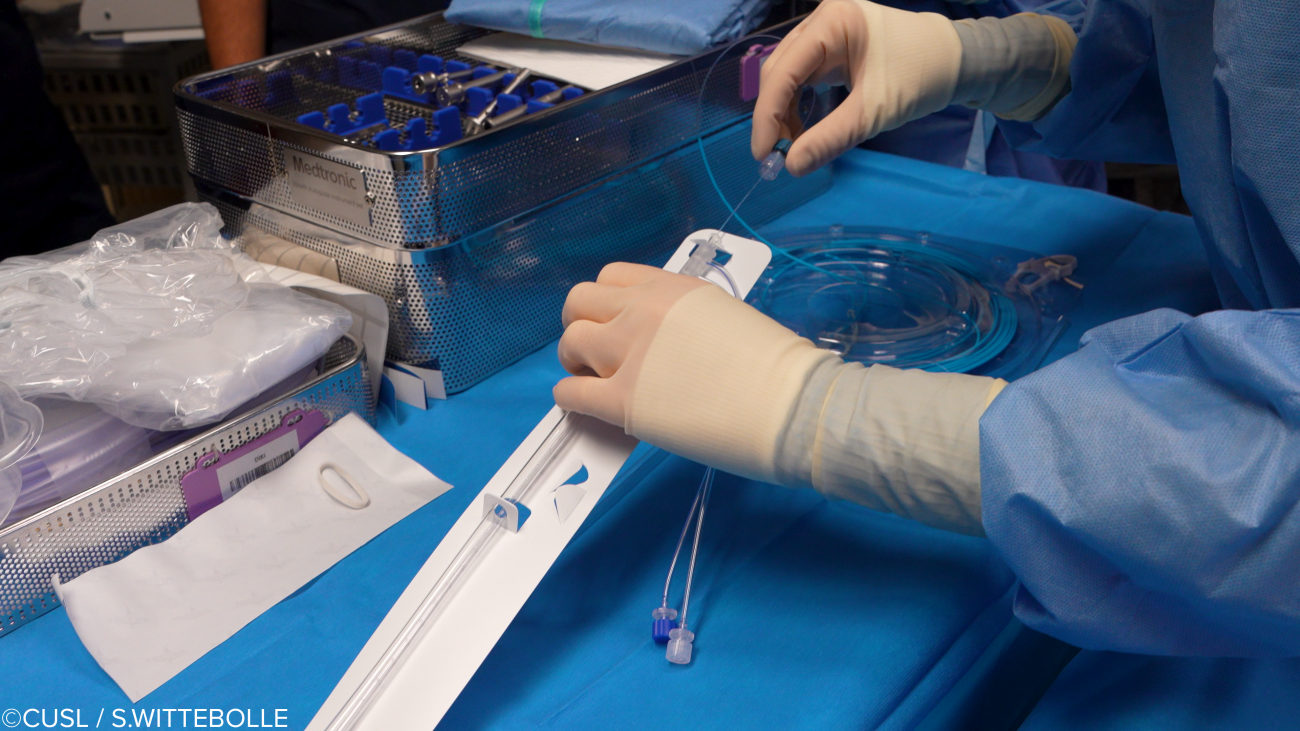 Neurochirurgie - opération d'épilepsie réfractaire