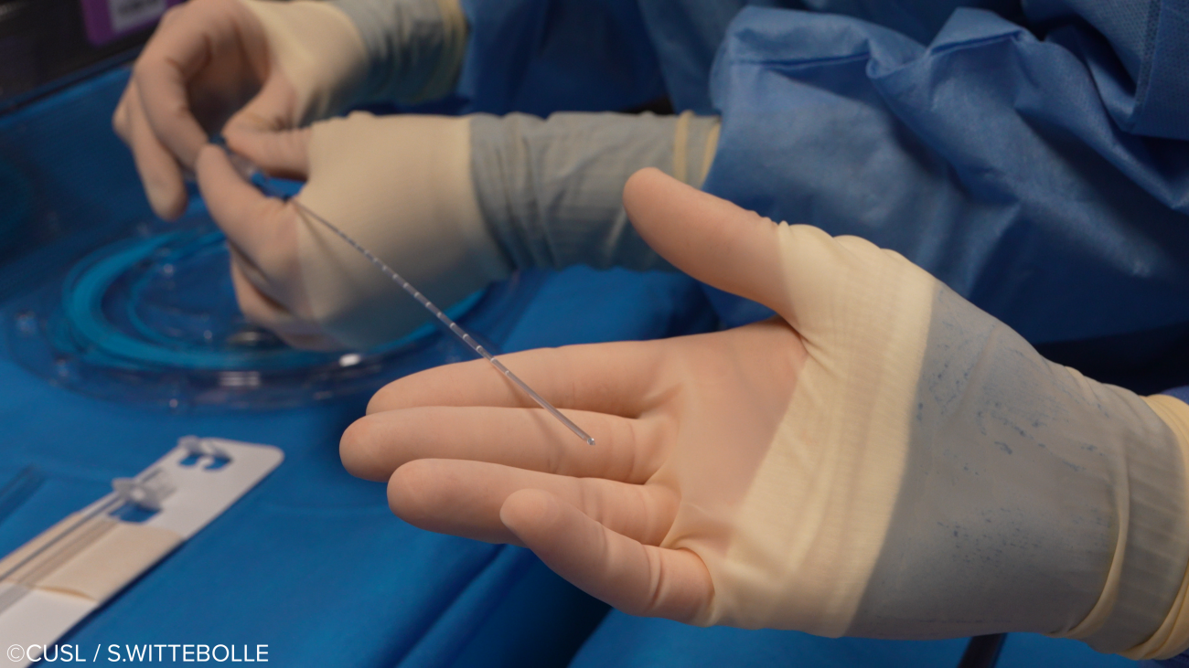 Neurochirurgie - opération d'épilepsie réfractaire