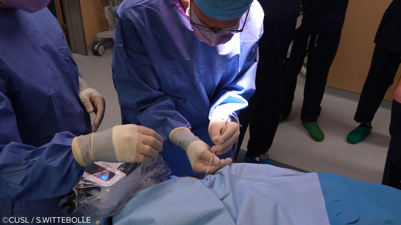 Neurochirurgie - opération d'épilepsie réfractaire