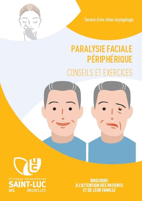 paralysie-peripherique