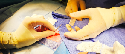 Implantation d'un micro-pacemaker chez un nouveau-né