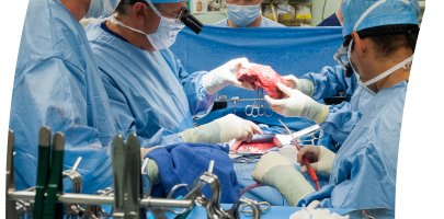 Transplantation hépatique