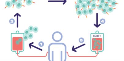 car-t cells