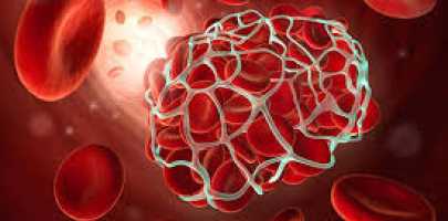 Anticoagulation
